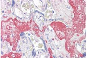 Anti-GAGED2 antibody IHC staining of human placenta. (XAGE1D anticorps  (AA 58-69))