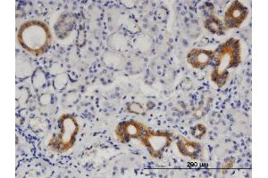 Immunoperoxidase of monoclonal antibody to SEPT8 on formalin-fixed paraffin-embedded human salivary gland.
