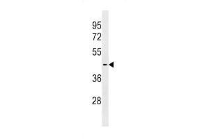 Western blot analysis in ZR-75-1 cell line lysates (35ug/lane).