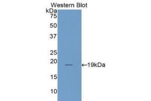 Detection of Recombinant IL1RA, Human using Polyclonal Antibody to Interleukin 1 Receptor Antagonist (IL1RA)