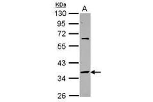 Image no. 1 for anti-Small Nuclear RNA Activating Complex, Polypeptide 2, 45kDa (SNAPC2) (AA 60-290) antibody (ABIN1501022)