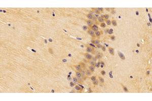 Detection of BMP2 in Rat Cerebrum Tissue using Polyclonal Antibody to Bone Morphogenetic Protein 2 (BMP2)