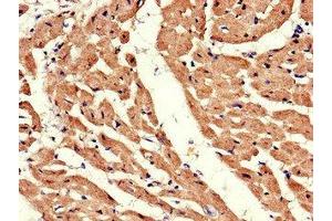 Immunohistochemistry of paraffin-embedded human heart tissue using ABIN7145355 at dilution of 1:100