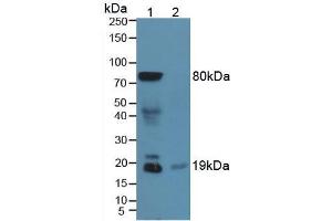 Figure. (Somatostatin anticorps  (AA 1-116))