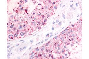 Anti-P2RY1 / P2Y1 antibody IHC of human testis. (P2RY1 anticorps  (N-Term))