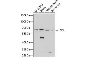 Western blot analysis of extracts of various cell lines, using LGI1 antibody (ABIN7268237) at 1:3000 dilution. (LGI1 anticorps  (AA 301-557))