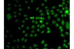Immunofluorescence analysis of A549 cells using TRPS1 antibody (ABIN5974943). (TRPS1 anticorps)