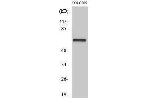 Western Blotting (WB) image for anti-Forkhead Box O4 (FOXO4) (Ser91) antibody (ABIN3175138) (FOXO4 anticorps  (Ser91))