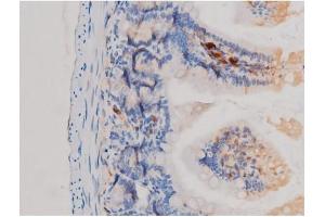 ABIN6267463 at 1/200 staining Mouse intestinal tissue sections by IHC-P.