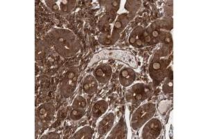 Immunohistochemical staining of human duodenum with MDFIC polyclonal antibody  strong cytoplasmic positivity in glandular cells.