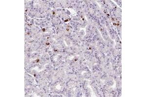 Immunohistochemical staining of human cerebral cortex with ASB1 polyclonal antibody  shows strong cytoplasmic positivity in neuronal cells and glial cells at 1:50-1:200 dilution. (ASB1 anticorps)