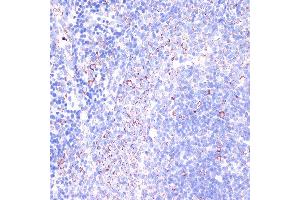 Immunohistochemistry of paraffin-embedded Rat spleen using CD18 antibody (ABIN3023117, ABIN3023118, ABIN3023119 and ABIN6219398) at dilution of 1:100 (40x lens).