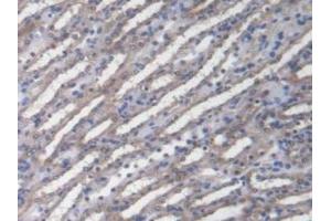 Detection of ZRF1 in Mouse Kidney Tissue using Polyclonal Antibody to Zuotin Related Factor 1 (ZRF1)