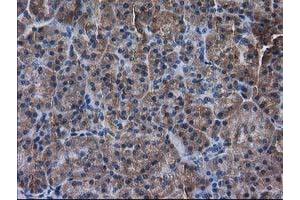 Immunohistochemical staining of paraffin-embedded Human pancreas tissue using anti-DSTN mouse monoclonal antibody. (Destrin anticorps)