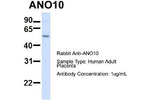 Host:  Rabbit  Target Name:  ANO10  Sample Type:  Human Adult Placenta  Antibody Dilution:  1. (Anoctamin 10 anticorps  (C-Term))