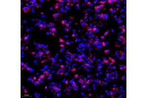 Immunofluorescence of paraffin embedded rat lung using TEAD3 (ABIN7075852) at dilution of 1: 700 (400x lens)