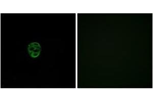 Immunofluorescence analysis of A549 cells, using OR2AE1 Antibody.