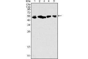 Western blot analysis using CK8 mouse mAb against A549 (1), Hela (2), MCF-7 (3), A431 (4) and HepG2 (5) cell lysate.