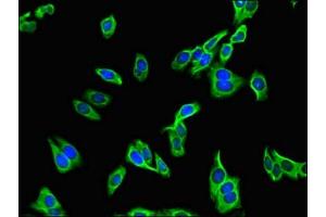anti-PDZ Domain Containing Ring Finger 3 (PDZRN3) (AA 133-404) antibody