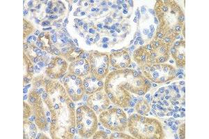 Immunohistochemistry of paraffin-embedded Rat kidney using GNAI2 Polyclonal Antibody at dilution of 1:100 (40x lens). (GNAI2 anticorps)