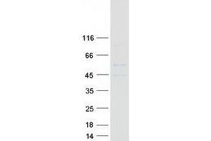 Validation with Western Blot