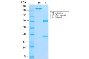 SDS-PAGE analysis of purified, BSA-free recombinant MyoD1 antibody (clone rMYD712) as confirmation of integrity and purity. (MYOD1 anticorps)