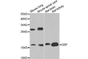 Western blot analysis of extracts of various cell lines, using GRP antibody (ABIN5973785) at 1/1000 dilution. (Gastrin-Releasing Peptide anticorps)