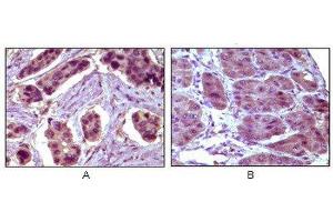 Immunohistochemistry (IHC) image for anti-B-Cell CLL/lymphoma 10 (BCL10) antibody (ABIN1842926) (BCL10 anticorps)