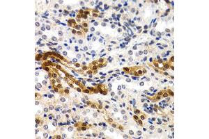 Immunohistochemistry of paraffin-embedded rat kidney using MT2A antibody at dilution of 1:200 (400x lens). (MT2A anticorps)