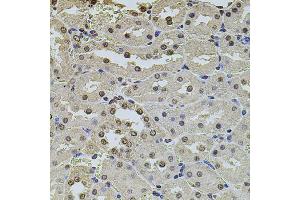 Immunohistochemistry of paraffin-embedded rat kidney using POT1 antibody (ABIN5970699) at dilution of 1/100 (40x lens). (POT1 anticorps)