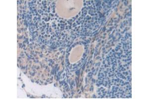 IHC-P analysis of Mouse Ovary Tissue, with DAB staining. (SERPING1 anticorps  (AA 397-495))