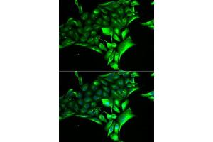 Immunofluorescence analysis of MCF-7 cells using PYGB antibody.
