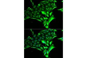 Immunofluorescence analysis of MCF-7 cells using PYGB antibody. (PYGB anticorps  (AA 544-843))