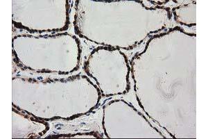 Image no. 4 for anti-Pyrroline-5-Carboxylate Reductase 3 (PYCRL) antibody (ABIN1500522)