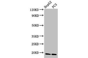 Western Blot Positive WB detected in: HepG2 whole cell lysate, PC-3 whole cell lysate All lanes: CAV2 antibody at 3 μg/mL Secondary Goat polyclonal to rabbit IgG at 1/50000 dilution Predicted band size: 19, 17, 13 kDa Observed band size: 19 kDa (Caveolin 2 anticorps  (AA 3-64))