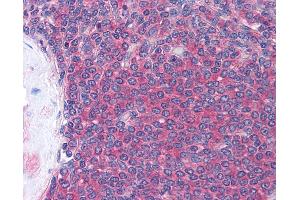 Anti-LCK antibody IHC of human spleen. (LCK anticorps  (AA 22-36))