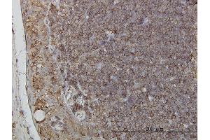 Immunoperoxidase of monoclonal antibody to RNF139 on formalin-fixed paraffin-embedded human tonsil.