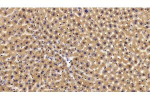 Detection of PYGL in Mouse Liver Tissue using Polyclonal Antibody to Glycogen Phosphorylase, Liver (PYGL)