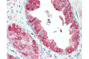 Human, Prostate:Formalin-Fixed Paraffin-Embedded (FFPE). (TROVE2 anticorps  (AA 20-69))
