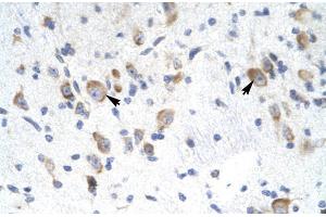 Rabbit Anti-GTF2F2 Antibody Catalog Number: ARP31437 Paraffin Embedded Tissue: Human Brain Cellular Data: Neural Cells Antibody Concentration: 4. (GTF2F2 anticorps  (Middle Region))