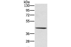 Western Blot analysis of 231 cell using SCPEP1 Polyclonal Antibody at dilution of 1:300 (SCPEP1 anticorps)