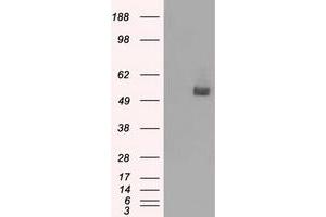 Western Blotting (WB) image for anti-CD36 (CD36) antibody (ABIN1497274) (CD36 anticorps)