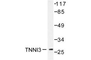 Image no. 1 for anti-Cardiac Troponin I (TNNI3) antibody (ABIN271938) (TNNI3 anticorps)