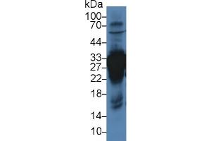 Western blot analysis of Rat Liver lysate, using Rat CA3 Antibody (3 µg/ml) and HRP-conjugated Goat Anti-Rabbit antibody ( (CA3 anticorps  (AA 27-217))