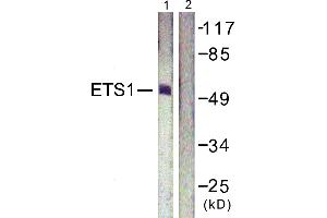 Immunohistochemistry analysis of paraffin-embedded human lung carcinoma tissue using ETS1 (Ab-38) antibody. (ETS1 anticorps  (Thr38))