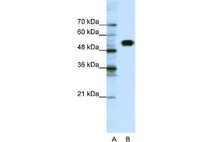 WB Suggested Anti-CLCNKB Antibody Titration:  0. (CLCNKB anticorps  (N-Term))