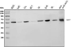 Western blot analysis of RBPJK/RBPJ using anti-RBPJK/RBPJ antibody (ABIN7601671).