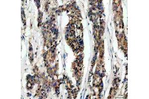 anti-NF-kappa-B inhibitor beta (NFKBIB) (AA 56-237) antibody