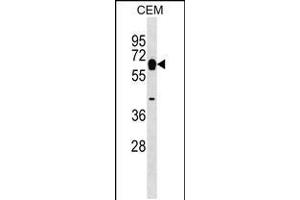 Western blot analysis in CEM cell line lysates (35ug/lane). (Myotilin anticorps  (AA 127-155))
