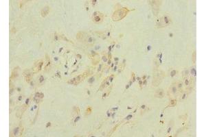 Immunohistochemistry of paraffin-embedded human placenta tissue using ABIN7176632 at dilution of 1:100 (ZFPM2 anticorps  (AA 982-1151))